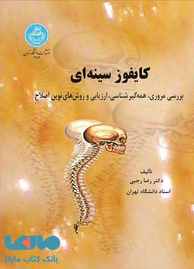 کایفوز سینه‌ای نشر دانشگاه تهران